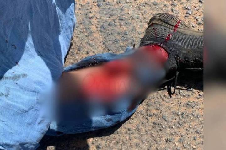 Comerciante tem perna dilacerada em acidente com carro em Rondônia