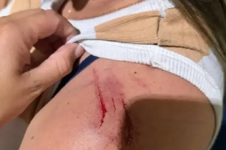 Mulher é espancada por ex-marido em Colorado do Oeste