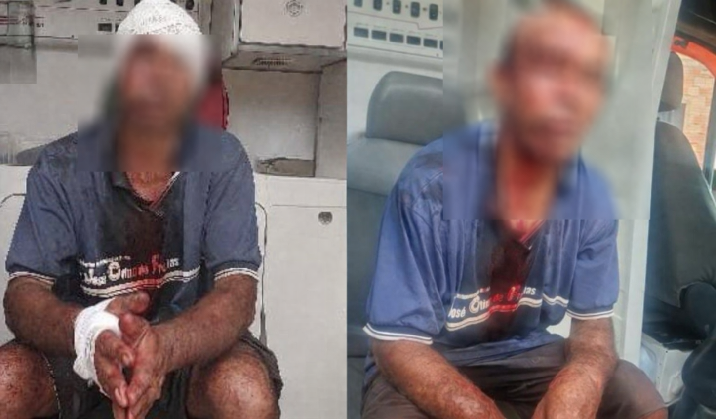 Homem diz que foi agredido durante roubo na zona leste e só acordou no centro